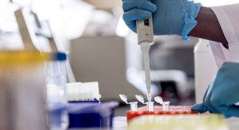VIH en Chile: Los desafíos de una enfermedad marcada por el prejuicio y que ha aumentado un 35% en la última década